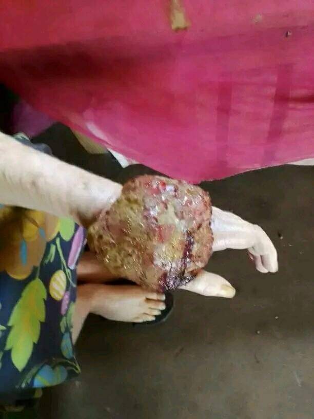 Dermathologie albinos