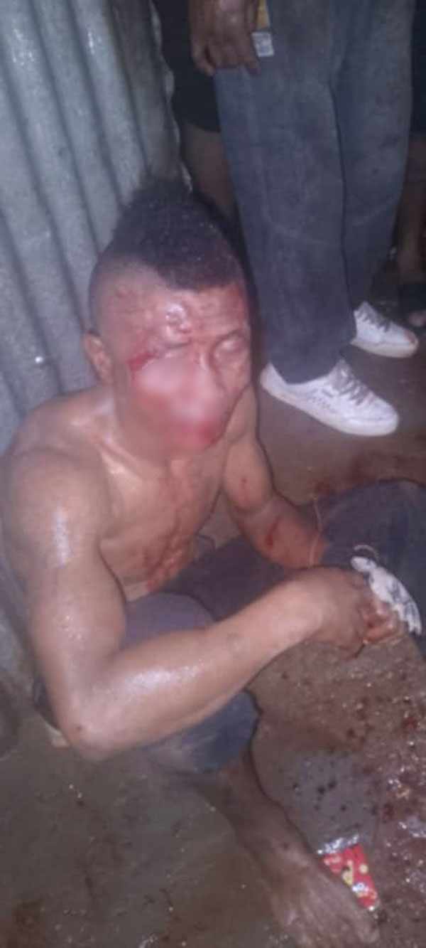 Bemasoandro Itaosy : Un voleur à la tire échappe de peu à la vindicte populaire